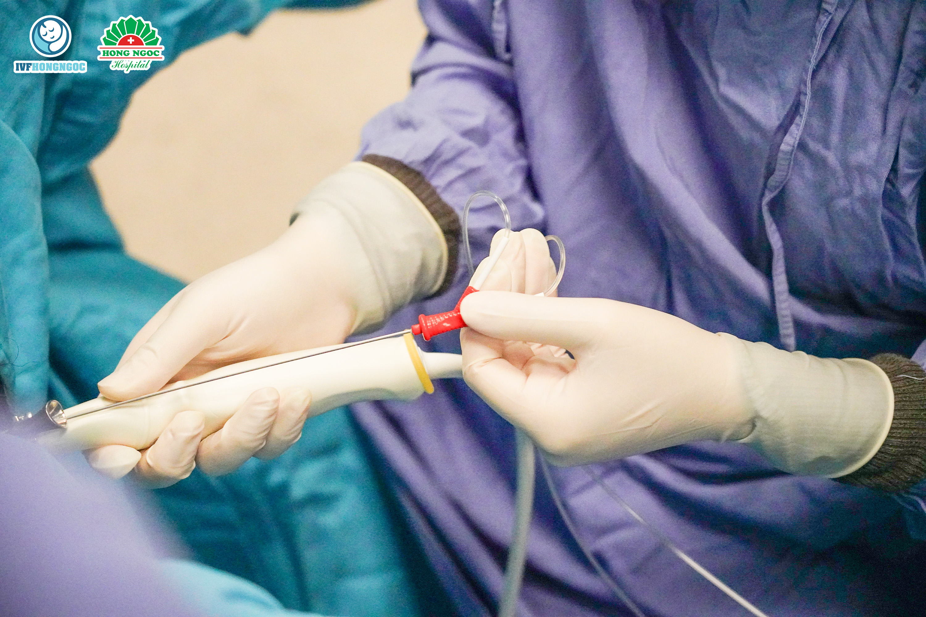 Quy trình IVF khép kín mang đến sự an toàn & hiệu quả cao